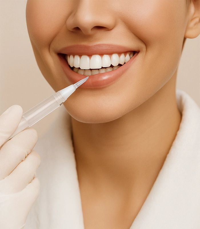 Blanchiment dentaire